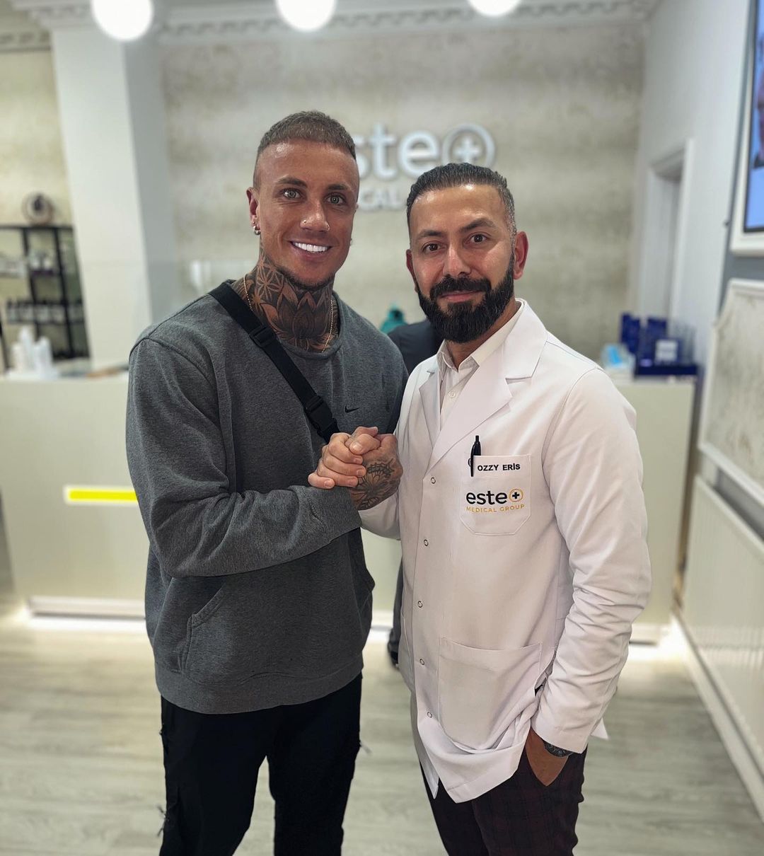 Baz Joins Este Medical Hair Transplant Ambassador Este